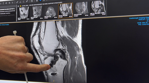 What Is the Meniscus?